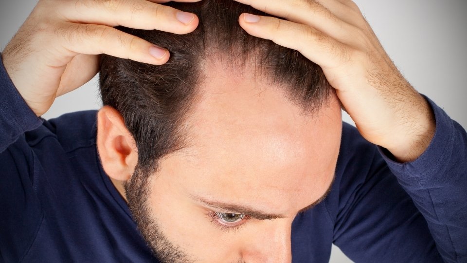 hair loss service